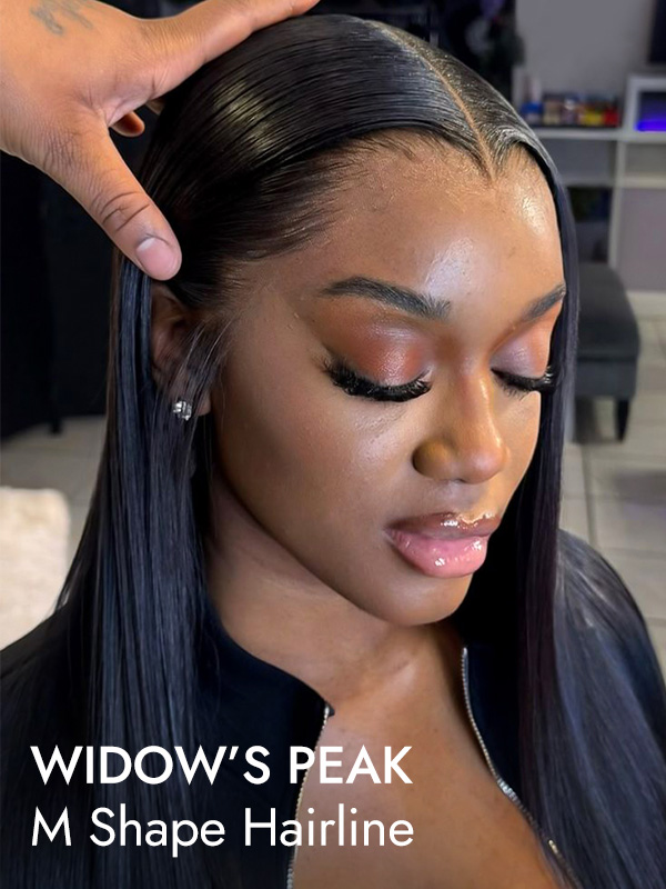 widow's peak hairline