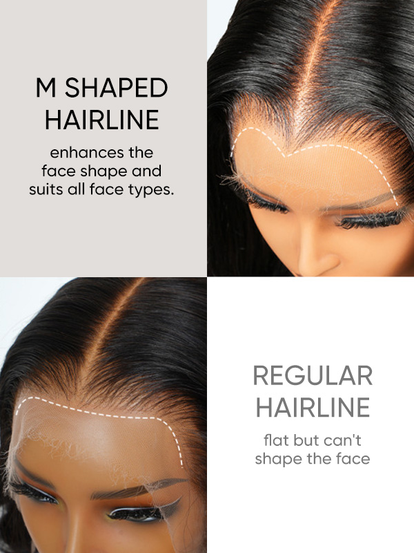 M hairline VS regular hairline