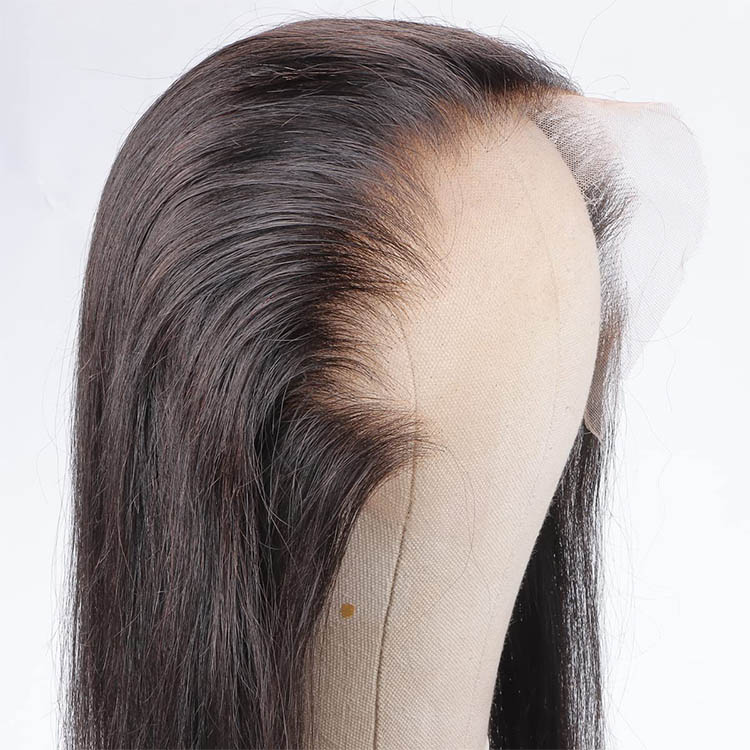 natural hairline