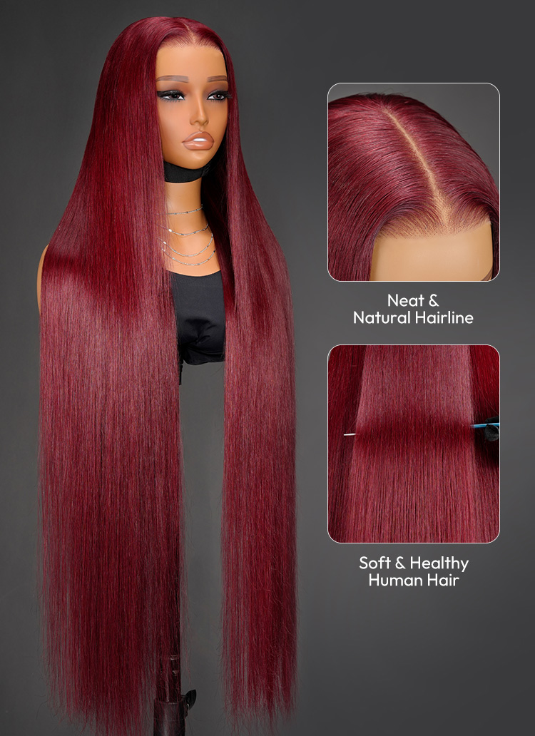 natural hairline
